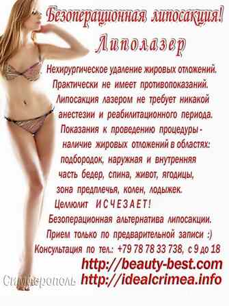 Вакуумно-роликовый массаж тела (лимфодренажный, LPG, аппарат Vortex). Симферополь Симферополь - изображение 4