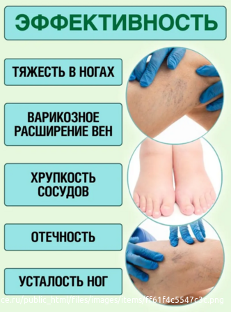 Акулья сила - акулий жир+троксерутин конский каштан кора ивы гель-бальзам для ног 100 мл Москва - изображение 5