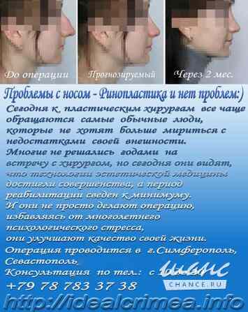 Врач - отоларинголог, пластический хирург Симферополь - изображение 2