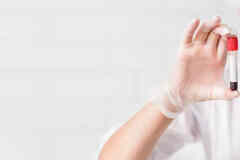 Лабораторные исследования с выездом на дом в Барнауле