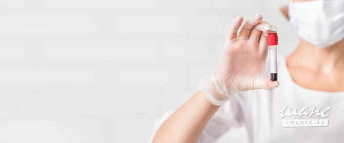 Лабораторные исследования с выездом на дом в Барнауле Барнаул - изображение 1