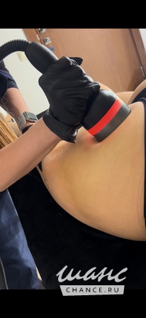 Аппаратный антицеллюлитный массаж и моментальный загар Казань - изображение 5